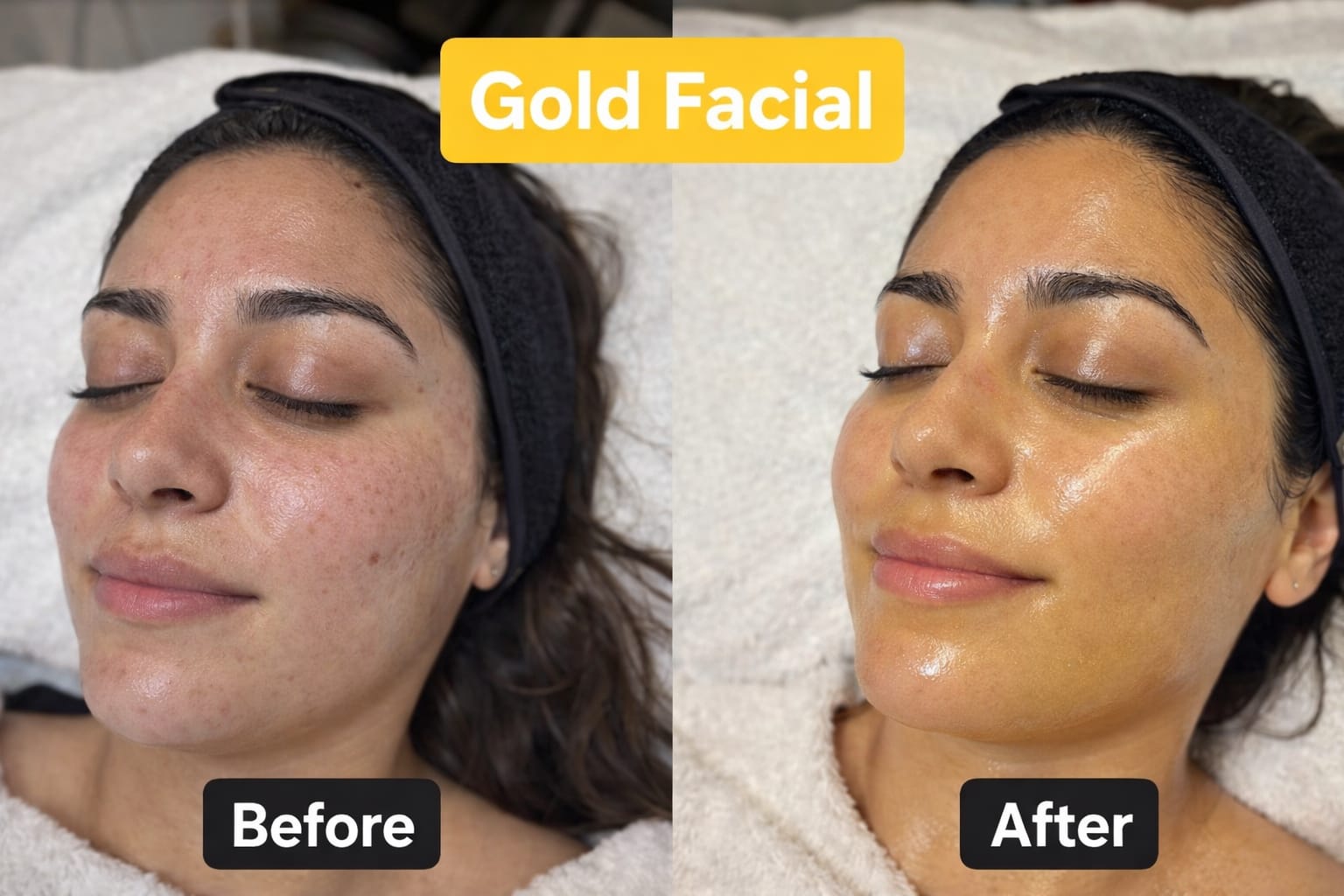 Before Facial